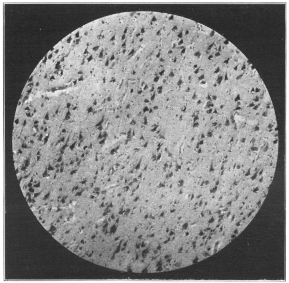 Photo, Cornell University Medical School


MICROPHOTOGRAPH OF BRAIN TISSUE